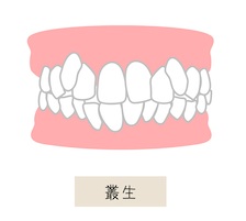 特徴