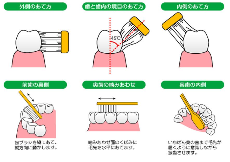 歯ブラシのあて方